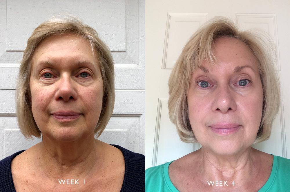 GlowCycle™ Serum Duo – Vitamin C (Day) + Retinol (Night)