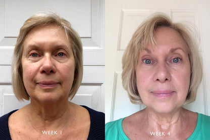 GlowCycle™ Serum Duo – Vitamin C (Day) + Retinol (Night)